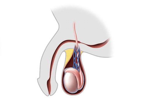 Urethral Stricture
